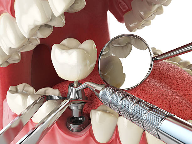 Best Mobile Emergency Dentist in Rehobeth, AL